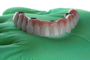 a full set of teeth with 4 holes for implants to be placed